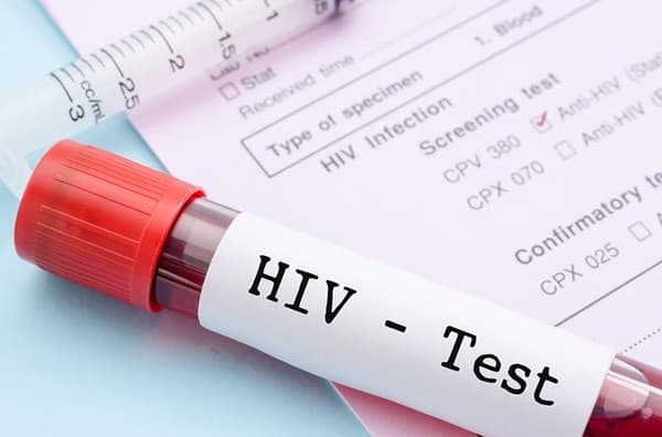   More than 1,300 security recruits tested positive for HIV - Muntaka 